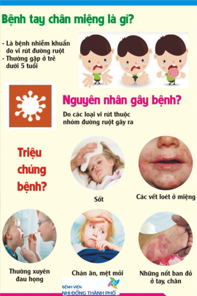 5 biện pháp phòng tay chân miệng cho trẻ các mẹ không thể bỏ qua